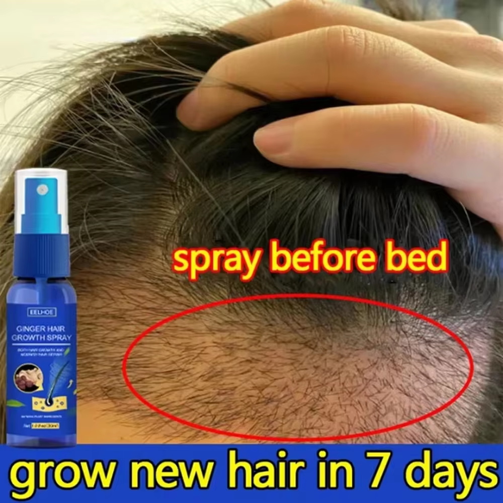 Hair Care Serum - 빠른 생강 모발 성장 스프레이, 모발