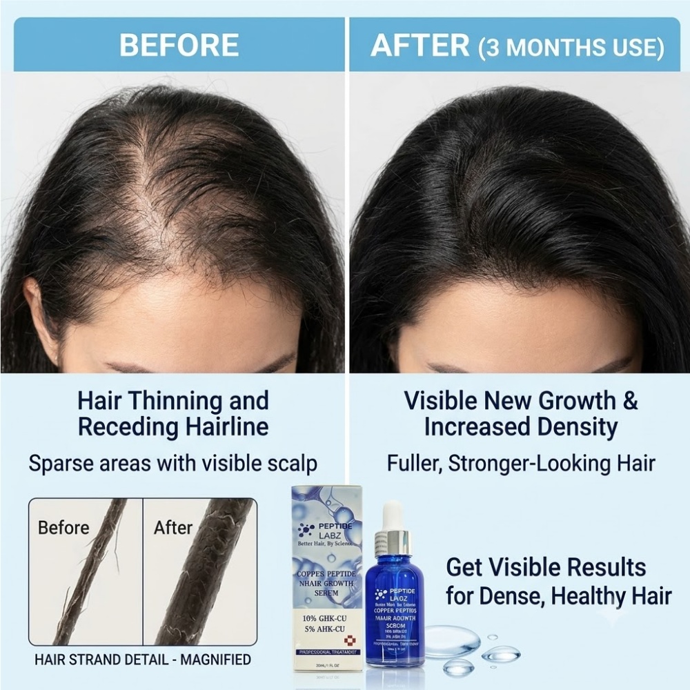 헤어 성장 에센스 구리 펩타이드 GHK Cu 탈모 방지 - Hair Care Elseve 리뷰 및 가격