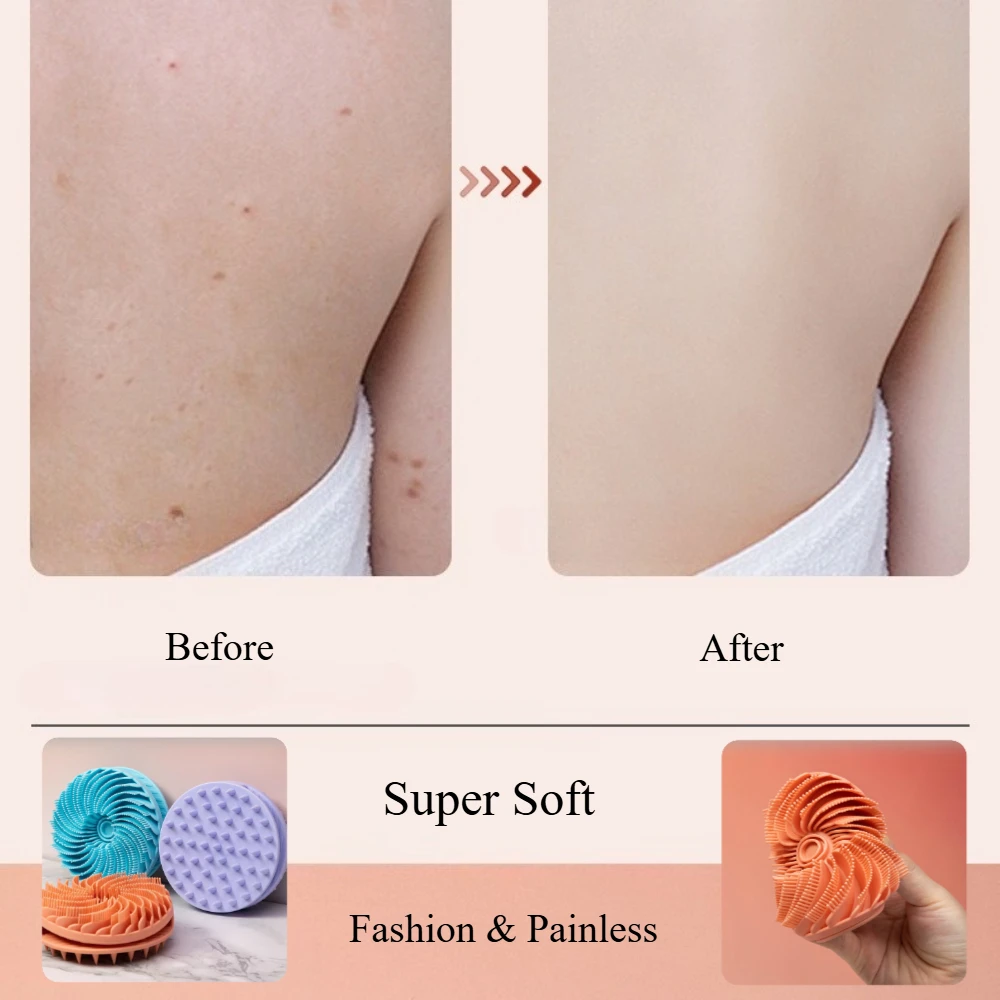 부드러운 실리콘 바디 스크러버 두피 각질 제거 비자극성 - Scalp Scrub Exfoliant 리뷰 및 가격