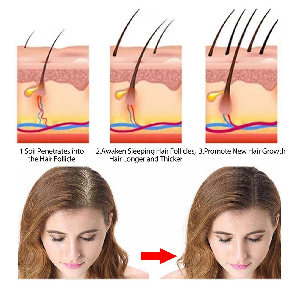 로즈마리 샴푸 비누 생강/대나무/라벤더/폴리곤움 멀티플 - Hair Care Elseve 리뷰 및 가격