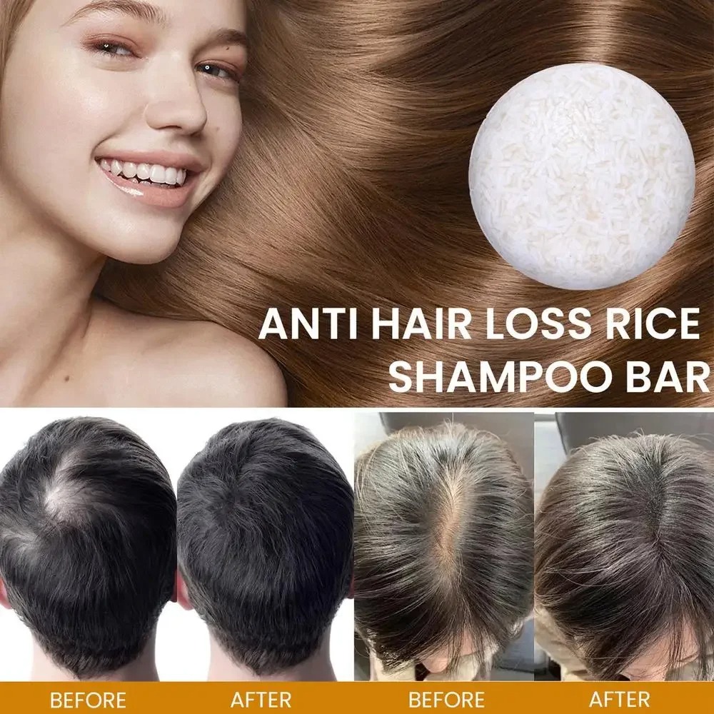 유기농 쌀 샴푸 비누 바, 오일 프리 컨디셔닝 비누,  - Hair Care Elseve 리뷰 및 가격