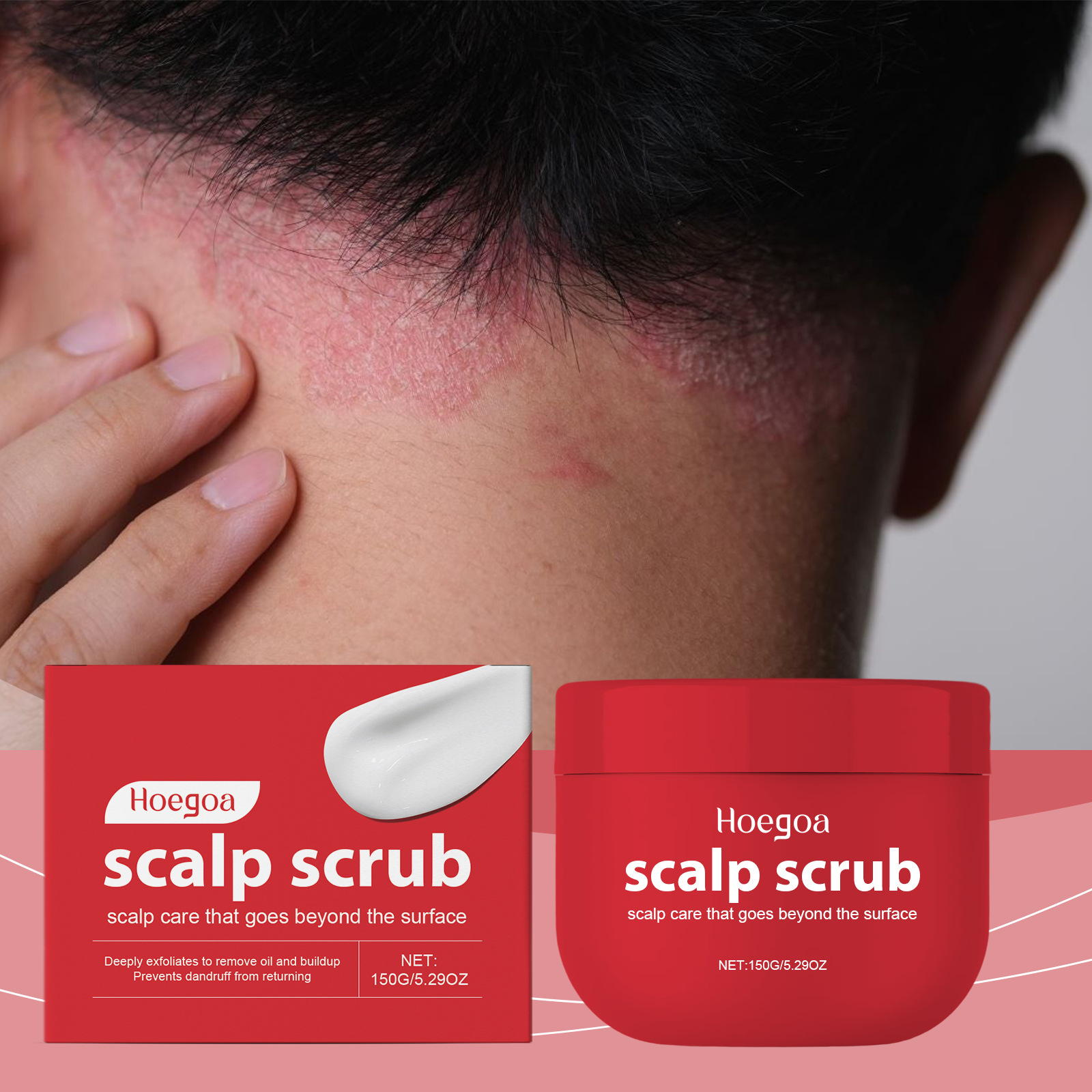 두피 스크럽 샴푸 오일 컨트롤 건조함 제거 각질 제거  - Scalp Scrub Exfoliant 리뷰 및 가격