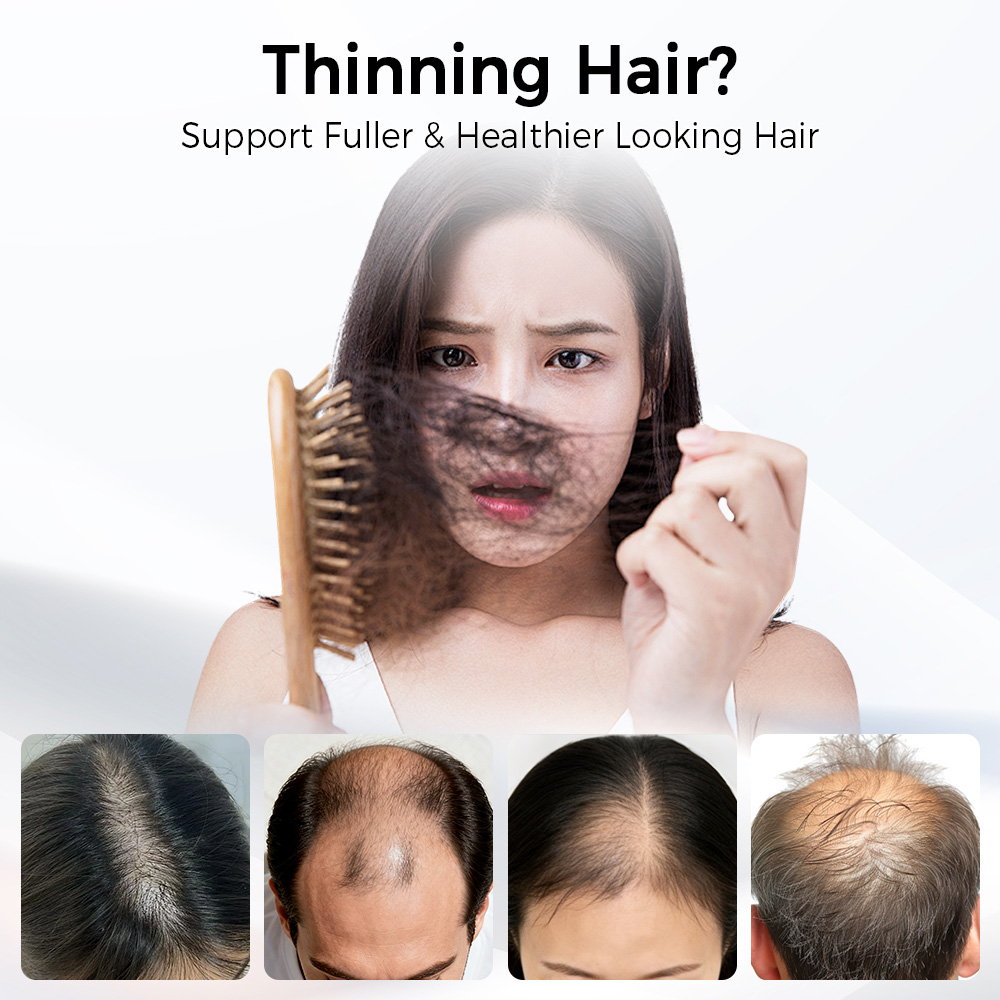 LED 헤어 성장 캡 레드 블루 라이트 테라피 모자 6 - Hair Care Elseve 리뷰 및 가격